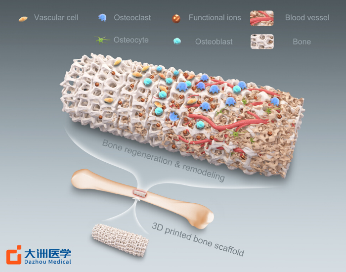 产品&解决方案-详细大图-人工骨.png